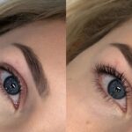 Czym jest zabieg liftingu rzęs?