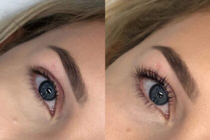 Czym jest zabieg liftingu rzęs?