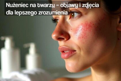 jak-wyglada-nuzeniec-na-twarzy-zdjecia